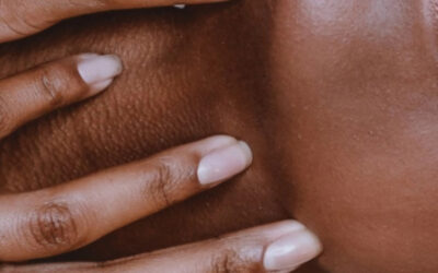 Common Skin Issues in Ethnically Diverse Individuals