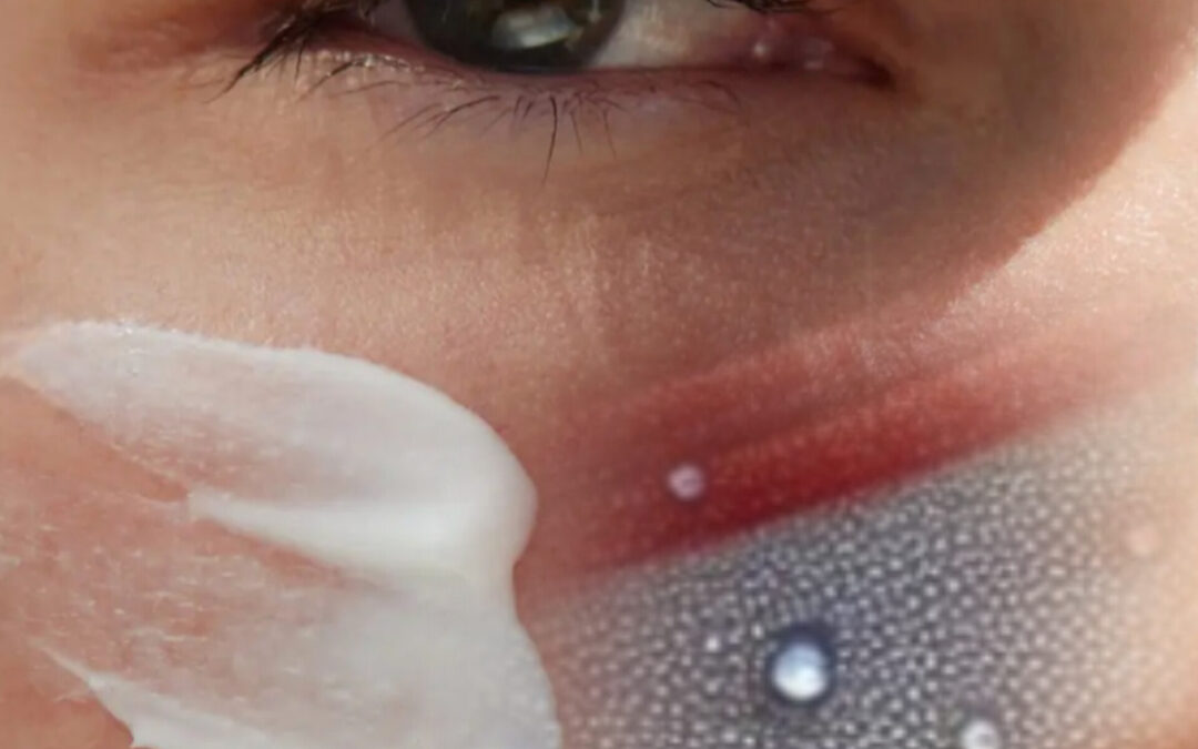 What is the Skin Barrier?